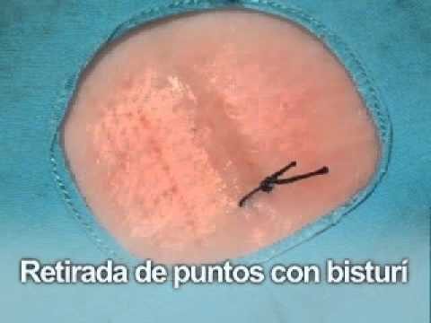 Tarifas por retiro de puntos: &iquest;Cu&aacute;nto cuesta?